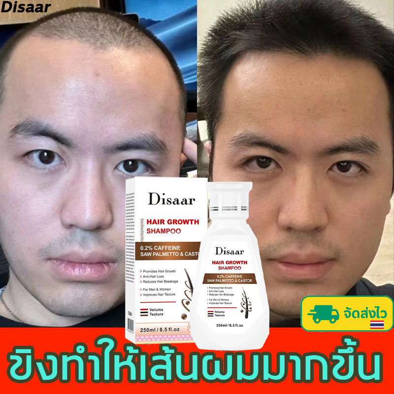 Disaar แชมพูขิง ผมร่วง ปลูกผม แชมพูป้องกันผมร่วง ต้าน DHT ป้องกันผมร่วง กระตุ้นการงอกของเส้นผม แก้ปั