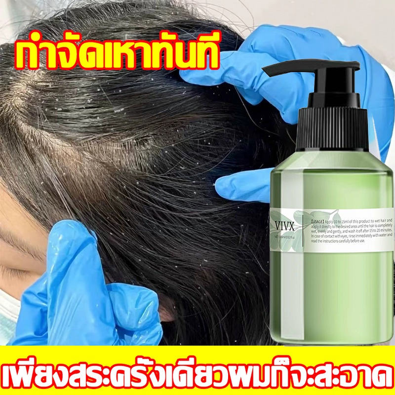 เหาหายไป！100MLแชมพูกำจัดเหา ธรรมชาติ ปลอดภัยไม่ระคายเคือง แชม แชมพูเหา ใช้ได้ปลอดภัยทั้งเด็กและผู้ใหญ่ บรรเทาอาการคัน