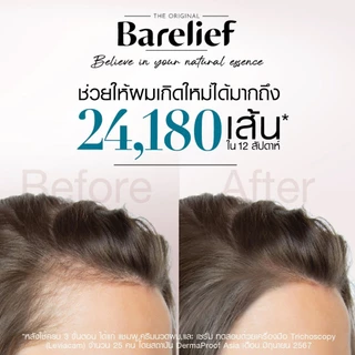 [เพิ่มปริมาณฟรี +20%] Barelief Red Ginseng Anti-Hair Loss Shampoo 300 ml แบร์รีลีฟ แชมพูโสมแดงเกาหลี ลดผมร่วง