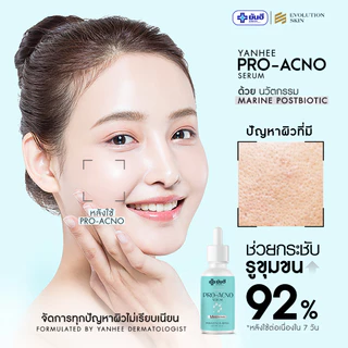 ยันฮี โปร-เอกโน่ Yanhee Pro Acno Serum เซรั่มลดสิวเวชสำอาง หลุมสิว รอยสิว สูตรอ่อนโยน