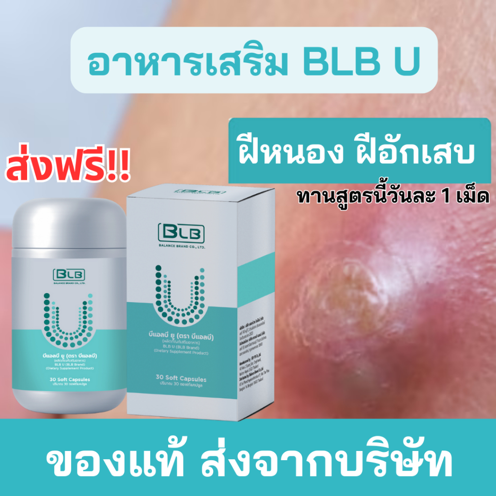 ผลิตภัณฑ์เสริมอาหาร BLB U (Balance U Core)  แก้ฝีอักเสบ ฝีคัณฑสูตร ด้วยสมุนไพร 13 ชนิด ของแท้