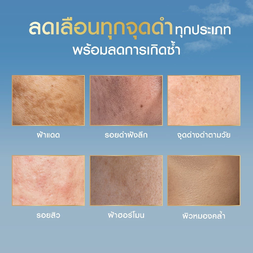 นีเวีย ลูมินัส630 แอนตี้สปอต แอนตี้-เอจ แอนด์ สปอต เซรั่ม 30 มล. NIVEA ไทอามิดอล เซรั่มลดริ้วรอย เซรั่ม thumbnail 7