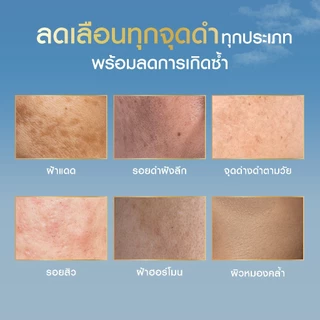 นีเวีย ลูมินัส630 แอนตี้สปอต แอนตี้-เอจ แอนด์ สปอต เซรั่ม 30 มล. ไทอามิดอล เซรั่มลดริ้วรอย 2ชิ้น NIVEA