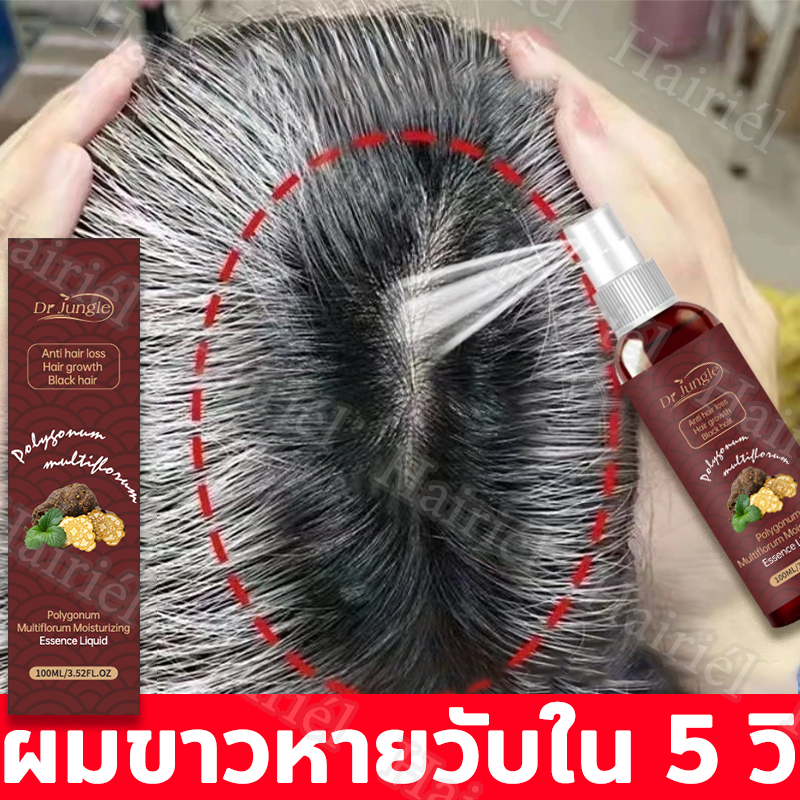 สเปรย์ปลูกผม ลดผมร่วง เพิ่มผมหนา กระตุ้นรากผม เร่งผมขึ้น แก้ผมบาง 100ml