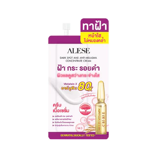 (3 ซอง) ALESE Dark Spot And Anti - Melasma Concentrate Cream อะลิเซ่ ดาร์คสปอต แอนด์ แอนตี้ เมลาสมา