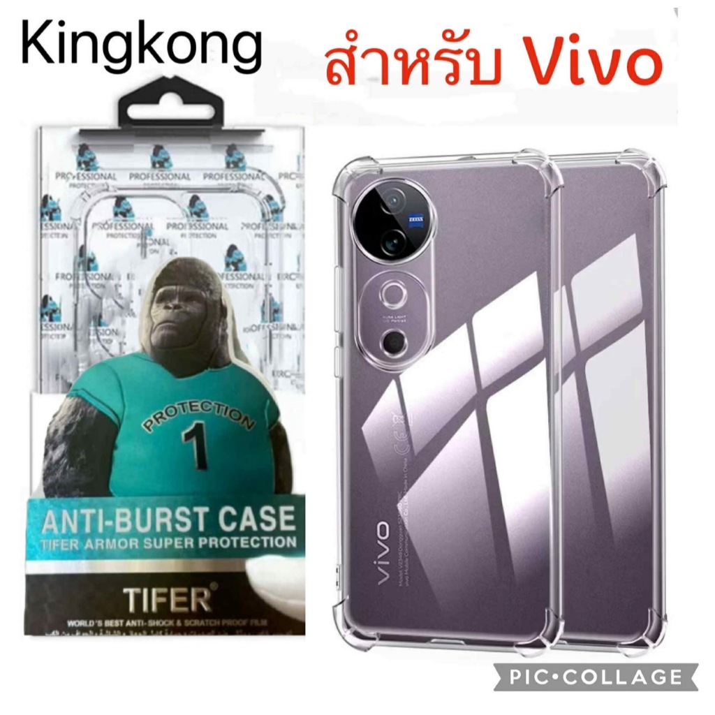 เคสใสแข็ง สำหรับ Vivo V40 V40pro V30 V30E V30pro V29 V29E V27 V27pro V25 V25pro V23 V23E เคสคิงคอง เคสใสกันกระแทก
