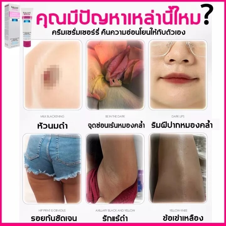 ครีมทารักแร้ขาว ครีมทาขาหนีบดำ 50 ml Kojic Acid Collagen Underarm Whitening Cream ครีมบำรุงรักแร้ ครีมทาขาหนีบ ครีมทาใต้ ราคา ถูกที่สุด ดีลบีเคเค แกลเลอรีภาพที่ 8