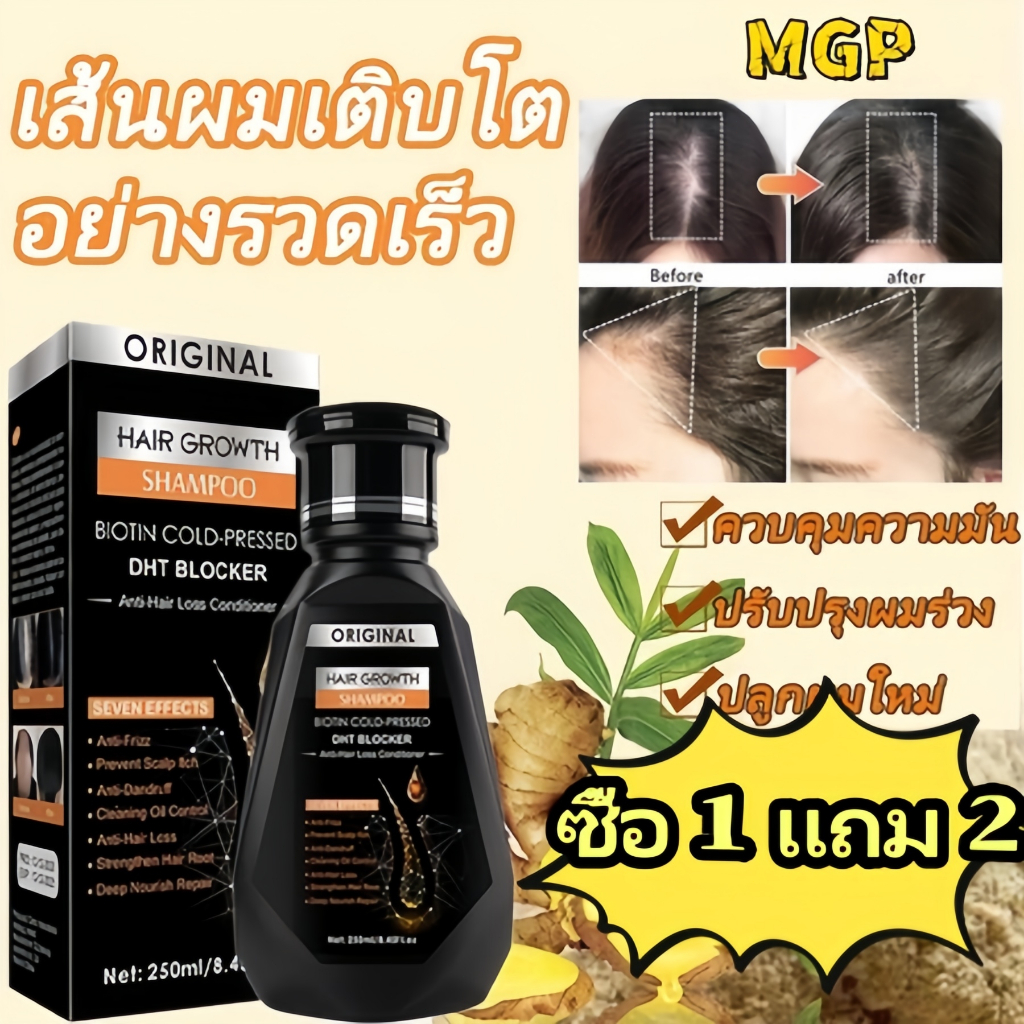แชมพูขิง แชมพูเร่งผมยาว DHT รักษาผมร่วง ป้องกันผมร่วง แชมพูสมุนไพรสกัดจากขิงสด บำรุงรากผม เร่งผมยาวอ