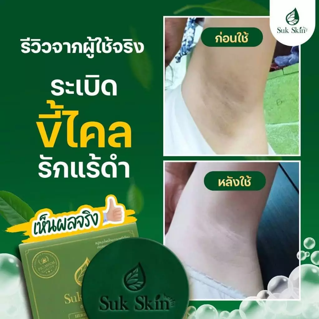(20 กรัม) Suk Skin สบู่ สบู่สมุนไพร สบู่ผิวขาว สบู่สมุนไพรแก้คัน สบู่ลดสิว สบู่สมุนไพรเย็น สบู่สมุนไพรสุขสกิน thumbnail 8