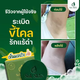 (20 กรัม) Suk Skin สบู่ สบู่สมุนไพร สบู่ผิวขาว สบู่สมุนไพรแก้คัน สบู่ลดสิว สบู่สมุนไพรเย็น สบู่สมุนไพรสุขสกิน