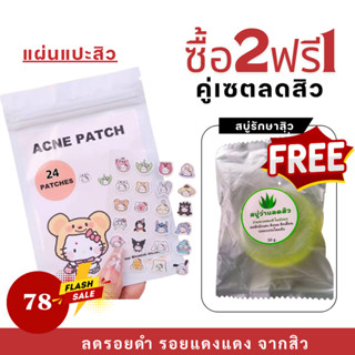 พร้อมส่ง!!แผ่นแปะรักษาสิวรูปการ์ตูน น่ารัก ซื้อ2 ซองรับสบู่ร…