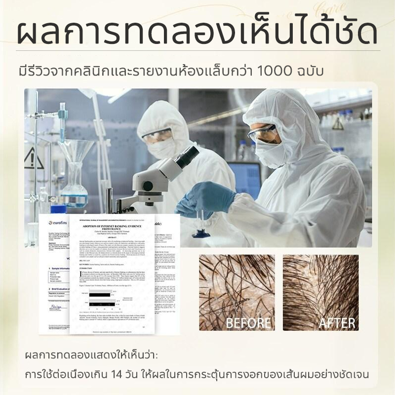 สเปรย์ปลูกผม ลดผมร่วง เพิ่มผมหนา กระตุ้นรากผม เร่งผมขึ้น แก้ผมบาง 100ml - รูปที่ 7