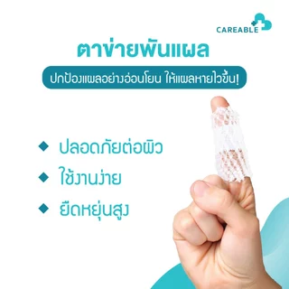 ตาข่ายพันแผล – ปกป้องแผลอย่างอ่อนโยน ให้แผลหายไวขึ้น!