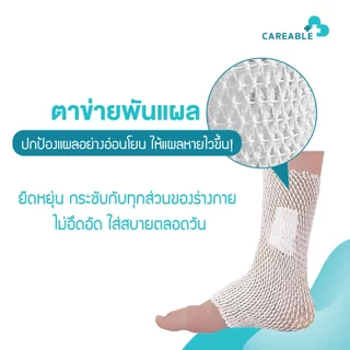 ตาข่ายพันแผล – ปกป้องแผลอย่างอ่อนโยน ให้แผลหายไวขึ้น!