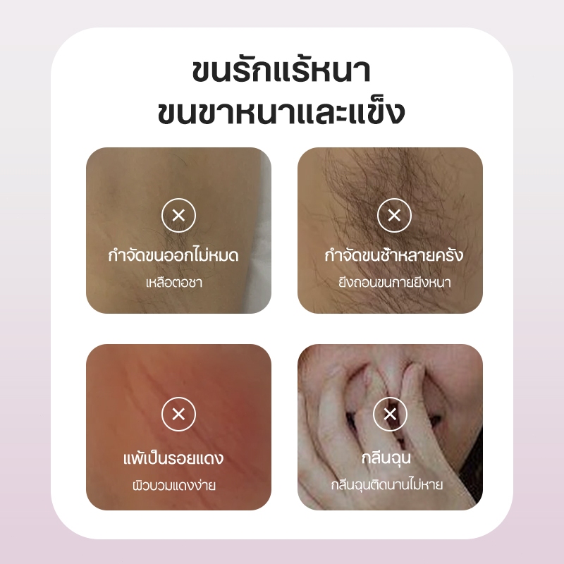 มูสกำจัดขน สเปรย์กำจัดขน กำจัดขนน้องสาว 150ml รักแร้ แขน หน้าอก ขา ลดขนไม่เจ็บตัว คนท้องใช้ได้ ไม่เหลือตอ ไม่แสบ ไม่คัน ราคา ถูกที่สุด ดีลบีเคเค แกลเลอรีภาพที่ 2