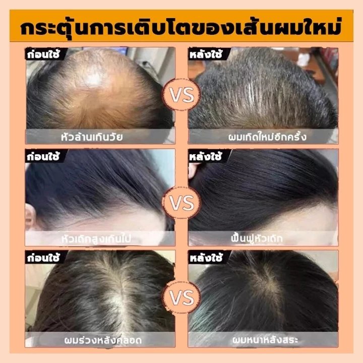 ซื้อ 1 แถม 1สินค้านำเข้าPEIMEI แชมพูแก้ผมร่วง แชมพูสมุนไพรขิงบำรุงผม250ml แชมพูปลูกผม ยาสระผมแก้ร่วง แชมพูขิงเพียว แชมพู - รูปที่ 2