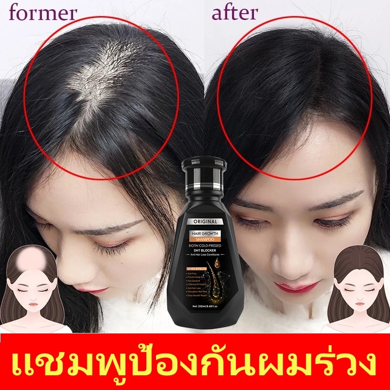 แชมพูสมุนไพร แชมพูดูแลเส้นผม แชมพูขิง 250ml สูตรเข้มข้นพิเศษ สกัดจากขิงสด ฟื้นบำรุงผมเสีย ช่วยให้ผมแลดูหนาขึ้น