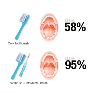 Dentalpro Interdental Brush " แปรงซอกฟัน " (มี Size 1,2,3) แปรงทำความสะอาดซอกฟัน