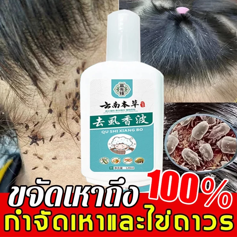 แชมพูฆ่าเหา✨ กำจัดเหาและไข่ถาวร แชมพูฆ่าเหา 120ml ขจัดเหาถึง100% ทําความสะอาดเส้นผมล้ำลึก ยาฆ่าเหา