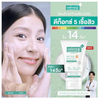 Smooth E Acne-5 Detoxify Non-Ionic Foam [50 ml. / 120 ml.] โฟมล้างหน้าลดสิว เสริมปราการผิวคุมมัน สิว