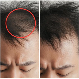 สเปรย์ฉีดผมหนาสูตรธรรมชาติ
