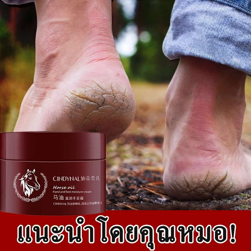 ซื้อ 1 แถม 1 ครีมทาส้นทาแตก 120g ครีมทาเท้าแตก ที่ขัดเท้าแตก ครีมบำรุงเท้า เท้าแตก ดูแลมือ ขัดผิวหนัง แห้ง หยาบ หนังแ