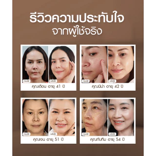 (รวมโปรดี) Minus20 ไมนัสทเวนตี้