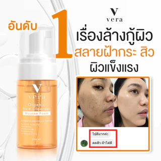 Vera Organic Rice Cleanser - มูสโฟมข้าวญี่ปุ่นออแกนิค ล้างลดสิว ฝ้ากระ จุดด่างดำ ผิวขาว กระจ่างใส