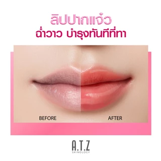 [ลิปปากแจ๋ว] A.T.Z SKINOLOGY MOISTLICIOUS LIP ลิปออยล์ปากฉ่ำบางเบา ไม่เหนียว บำรุงริมฝีปาก ริมฝีปากชุ่มชื้น Lip Oil 6.2g