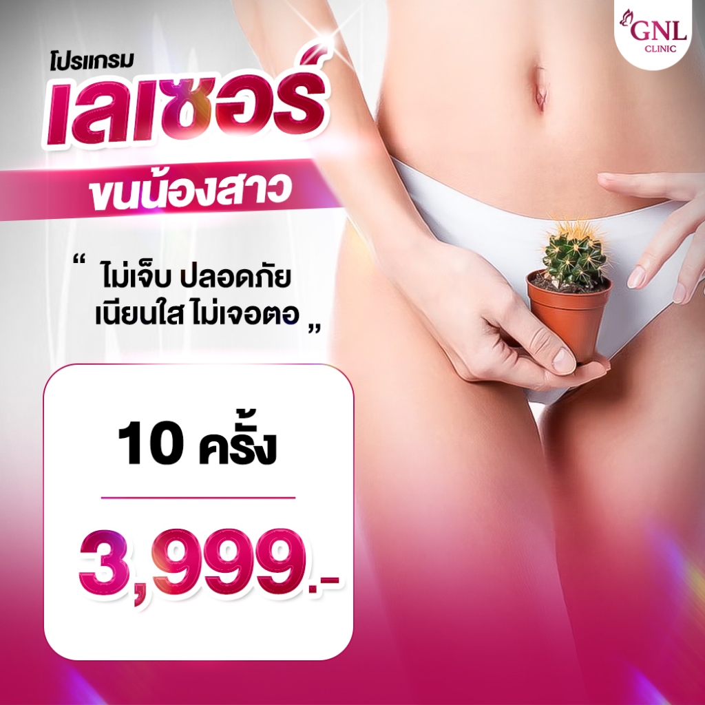 เลเซอร์ขนน้องสาว เครื่องกำจัดขน กําจัดขนถาวร GNL Clinic
