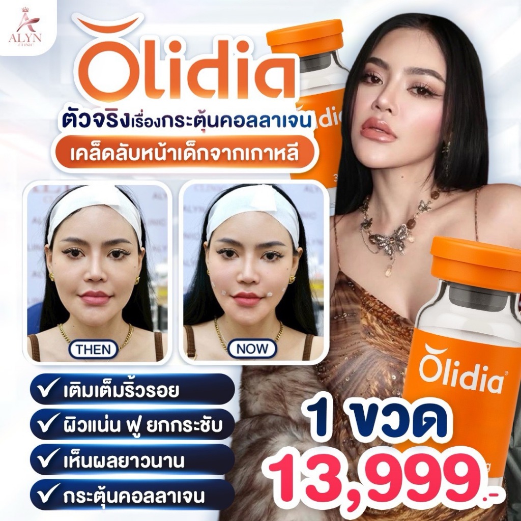 Olidi ตัวจริงเรื่องกระตุ้นคอลลาเจ้น เคล็ดลับหน้าเด็กจากเกาหลี Alyn clinic
