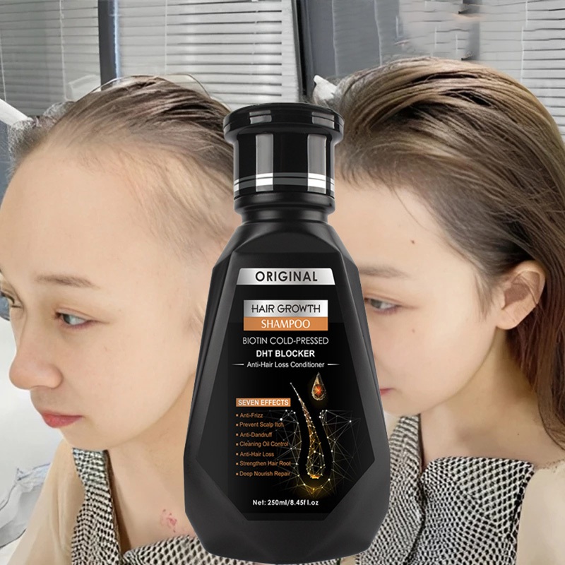 PEIMEI แชมพูสมุนไพรขิงบำรุงผม 250ml แชมพูปลูกผม แชมพูปลูกผมดก ยาสระผมเร่งผมยาว แชมพูขิง แชมพูสมุนไพร แชมพูบำรุงผม