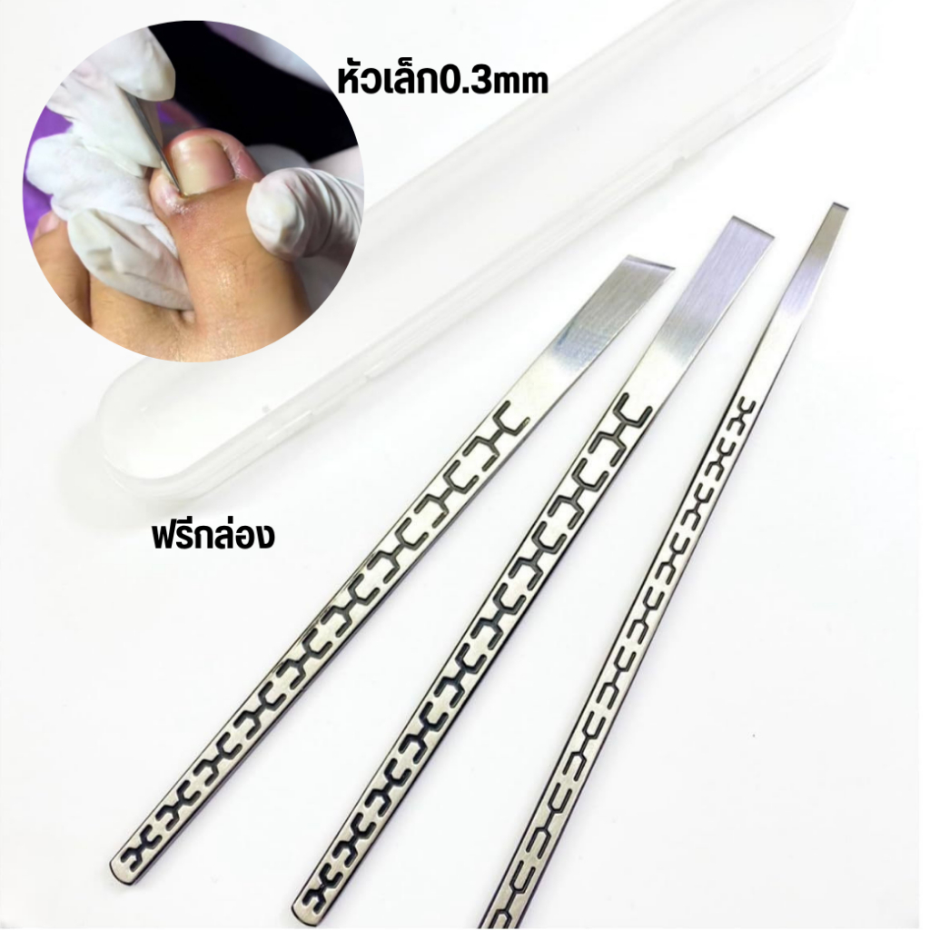 ชุดทำเล็บขบอย่างดี หัวเล็ก0.3mm งานแข็งแรงหนาทน คม ใบมีดมีความคมมาก ง่ายต่อการตัดเล็บขบแบบถึงรากถึงโคนเล็บเท้า ฟรีกล่อง