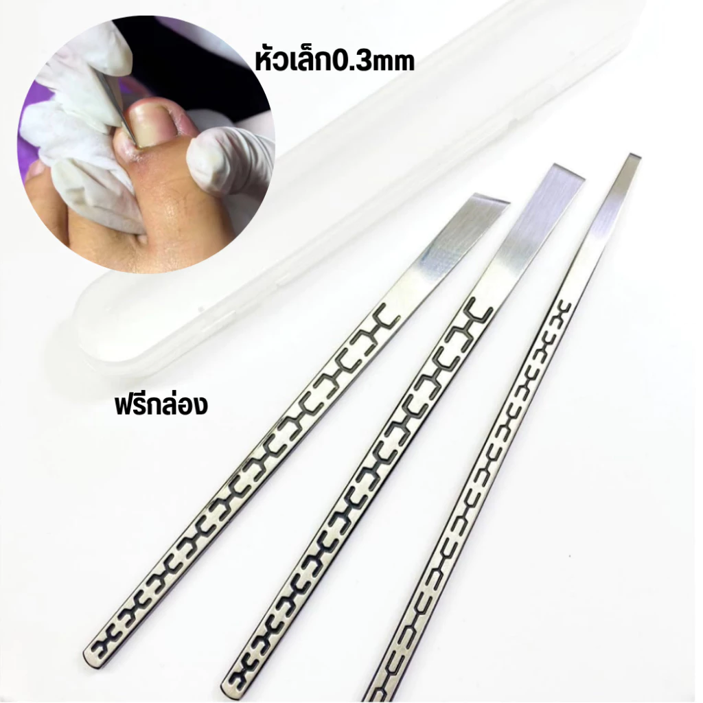 ชุดทำเล็บขบอย่างดี หัวเล็ก0.3mm งานแข็งแรงหนาทน คม ใบมีดมีความคมมาก ง่ายต่อการตัดเล็บขบแบบถึงรากถึงโคนเล็บเท้า ฟรีกล่อง