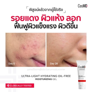 CosMD มอยส์เจอร์ไรซิ่ง เนื้อเจล สำหรับคนเป็นสิว ผิวแห้งกร้าน, ผิวขาดน้ำ และช่วยให้ผิวเนียนนุ่ม สำหรับผิวแพ้ง่ายเป็นพิเศษ