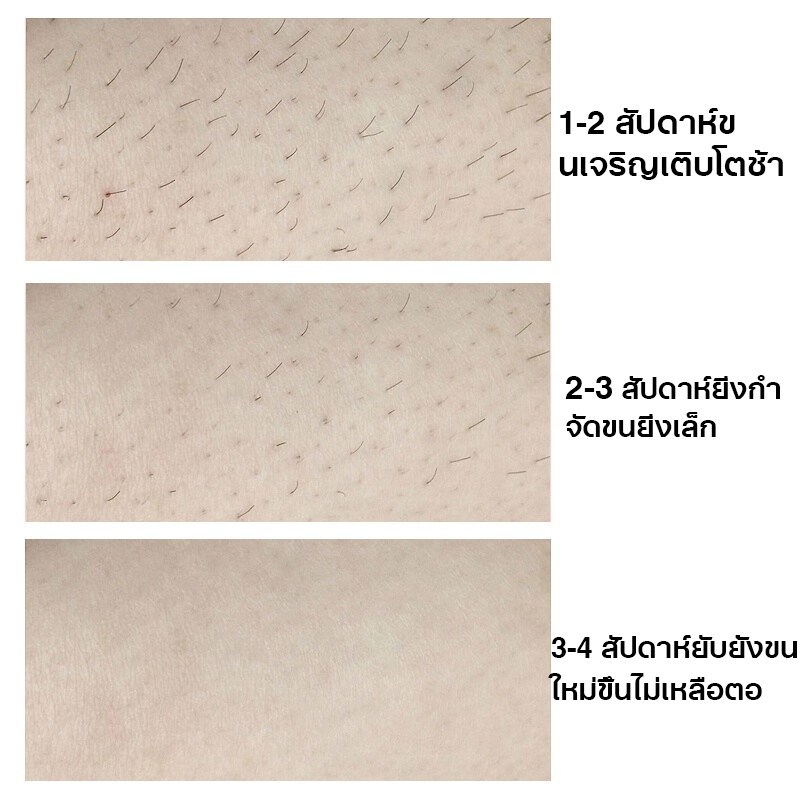 รูปภาพ 3