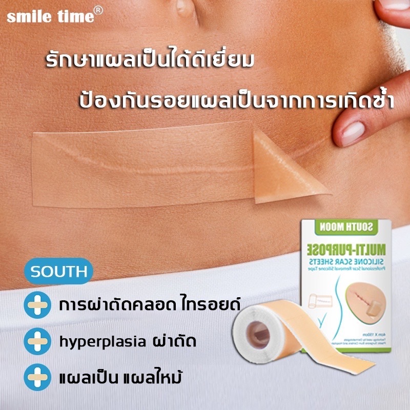 South Moon รักษารอยแผลเป็น แผ่นแปะแผลเป็น 4cm*150cm กําจัดรอยแผลเป็นจากแผลเป็น เผยผิวเนียนสวย - รูปที่ 3