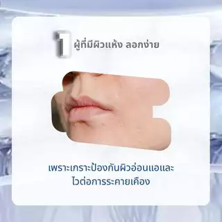 Sanderma เจลอาบน้ำ สูตรอ่อนโยน ฟื้นฟูผิวแพ้ง่าย ลดการอักเสบ ระคายเคืองและรอยแดง 300g