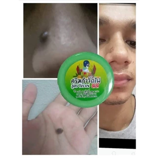 ( พร้อมส่ง) ครีมกำจัดไฝ ครีมไฝ ขี้แมงวัน ตาปลา หูด ติ่งเนื้อ