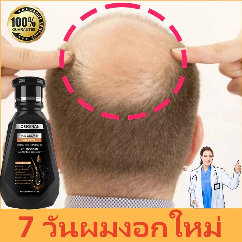 🔥โปร 2 แถม 1 ✅แชมพูขิงสำหรับเสริมความแข็งแรงและเพิ่มปริมาณเส้นผม แชมพูปลูกผม แชมพูผมหนา บำรุงลึก ฟื้นฟูเส้นผม สารสกัดจาก
