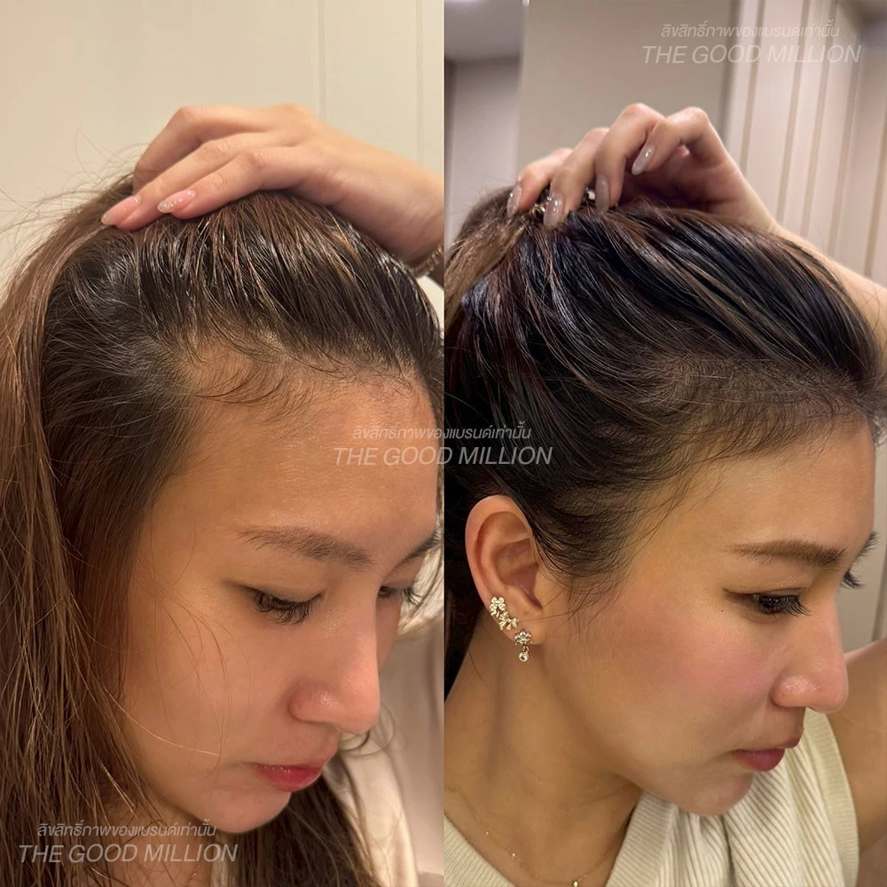 Hair Serum เซรั่มบำรุงผม นวัตกรรม 3 สูตรเพื่อผมสวยครบมิติ ฟื้นฟูผม เร่งผมยาว ผมหนา ผมสวย โคนจรดปลาย thumbnail 6
