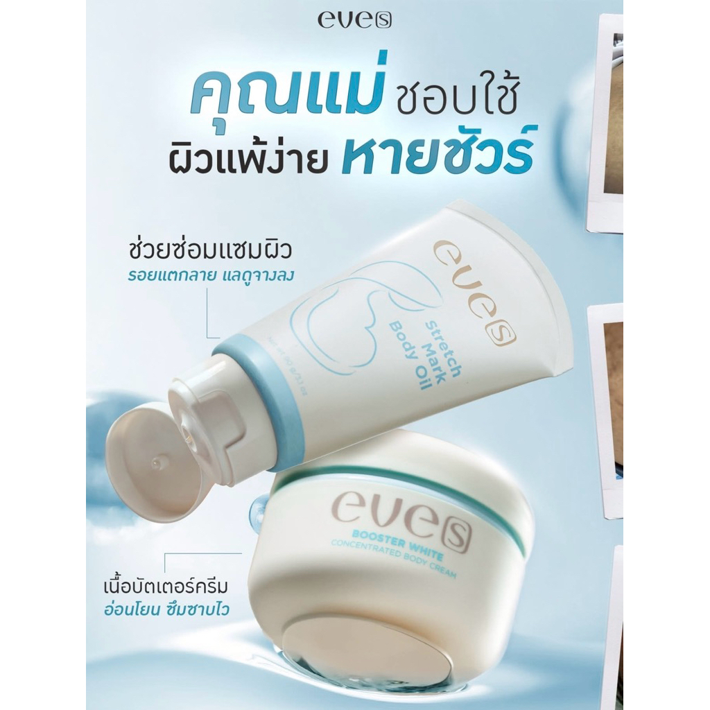 NEW EVE’S เซตคู่บูสเตอร์ฟ้า อีฟส์ออยล์ ลดรอยแตกลาย รอยแผลเป็น ผิวชุ่มชื้น เห็นผลไวx2 คนท้องใช้ได้