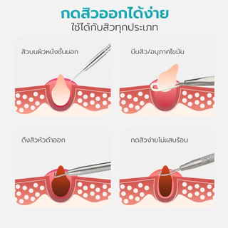 Simple Health ที่กดสิว 7ชิ้น ที่กดสิวสแตนเลส Acne tool สแตนเลสอย่างดี ไม่ขึ้นสนิม พร้อมกล่อง