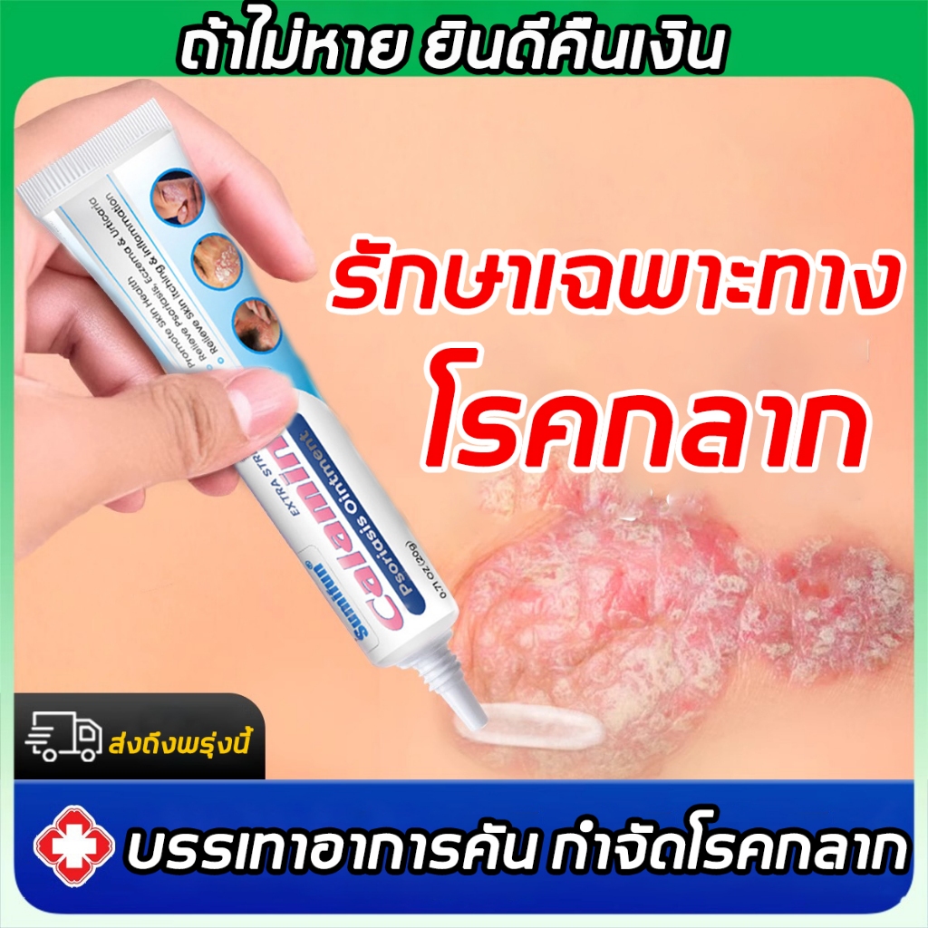【COD】ครีมแก้คัน 20g สะเก็ดเงินครีม รอยแดง าสะเก็ดเงิน โรคผิวหนัง เกลื้อน กลาก คัน สมุนไพร ผิวแห้งและคัน