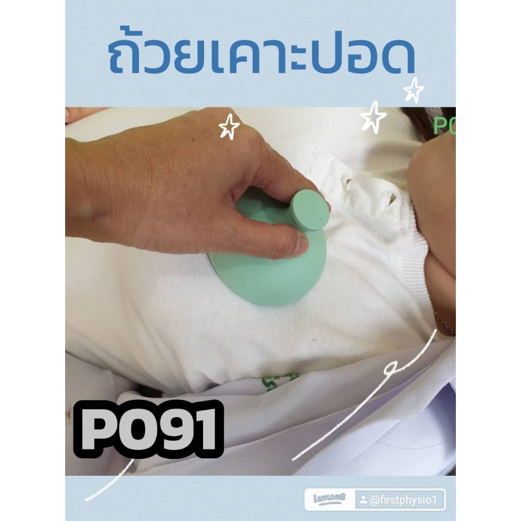 ถ้วยเคาะปอด/อุปกรณ์เคาะปอดระบายเสมหะ