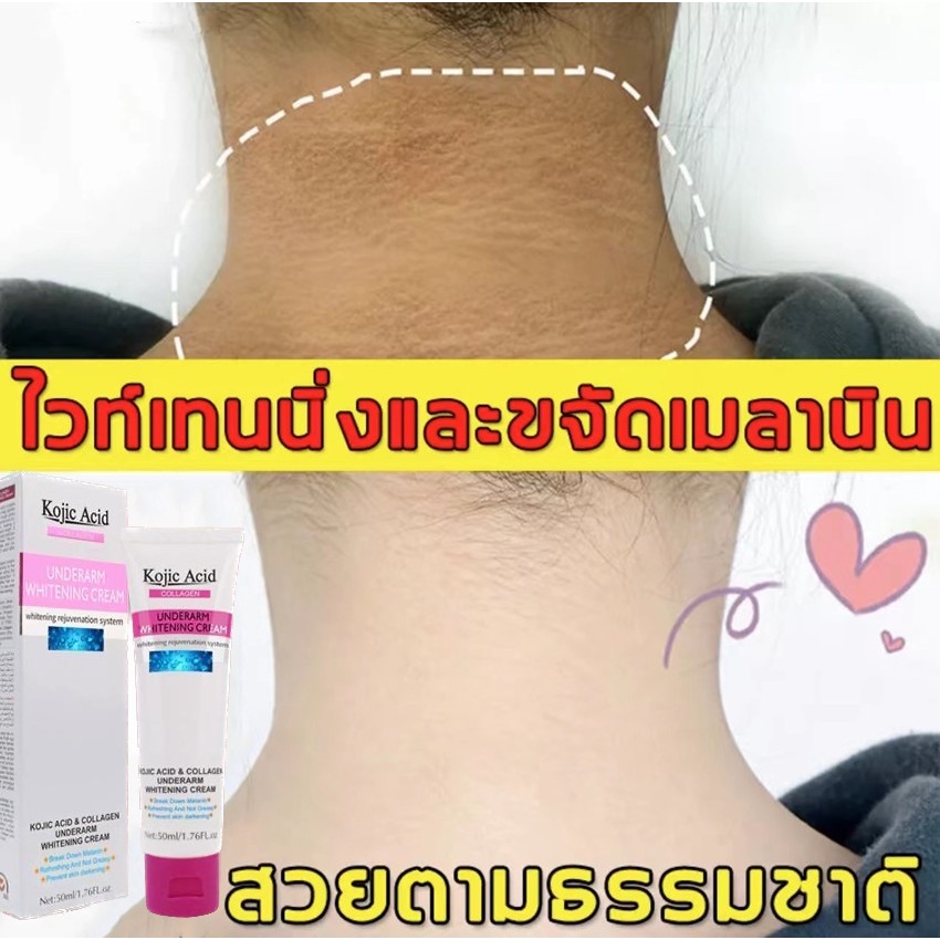 ครีมทารักแร้ขาว ครีมทาขาหนีบดำ 50 ml Kojic Acid Collagen Underarm Whitening Cream ครีมบำรุงรักแร้ ครีมทาขาหนีบ ครีมทาใต้