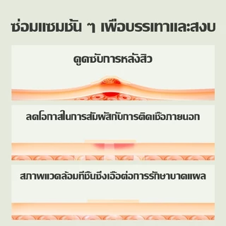 แผ่นแปะดูดสิว แผ่นแปะสิว ปกปิดรอยสิว แผ่นสติกเกอร์แปะสิว 28 ชิ้น รักษาสิว แผ่นดูดสิว รูปดาว หลากสี กันน้ำ