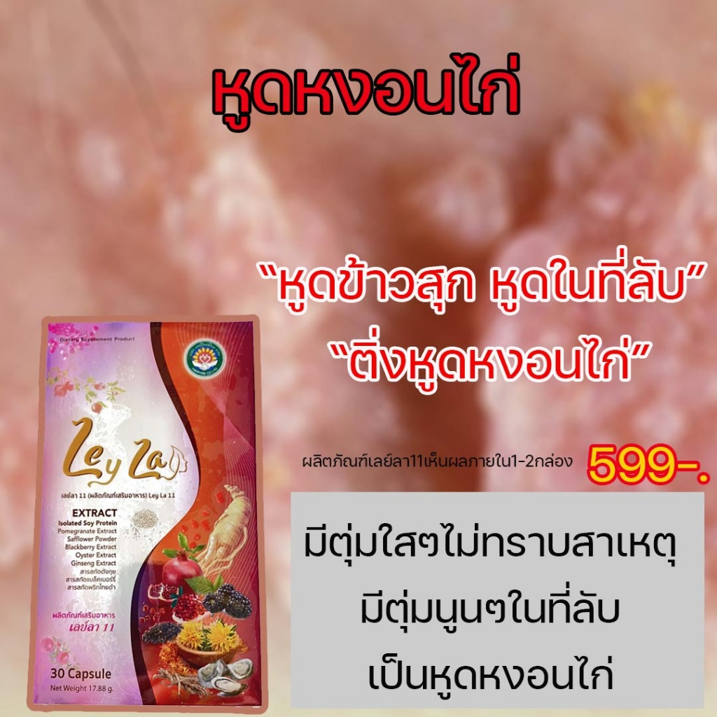 หูดหงอนไก่ ติ่งหูดหงอนไก่ ผลิตภัณฑ์Leyla11สมุนไพรรักษาหูดหป้องกันหูดหงอนไก่ตุ่มทุกชนิด - รูปที่ 3