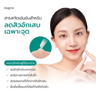 MORTIW หมอทิว Anti Acne & Blemish Gel เจลแต้มสิว สิวอักเสบ เป็นสิวบ่อย ลดรอยแดง 15 g.