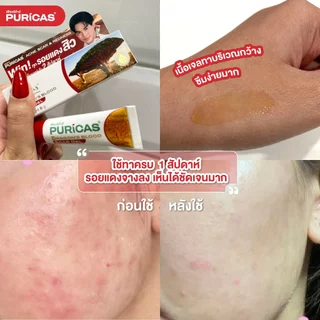 [เพิ่มปริมาณฟรี 2 กรัม] Puricas scar gel 8g.+2g. ลดรอยแดงจากสิว